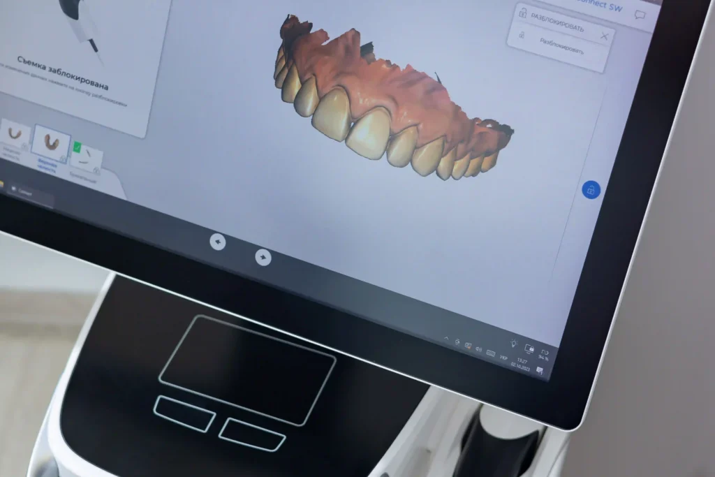 3D Diş tarama görüntüleme